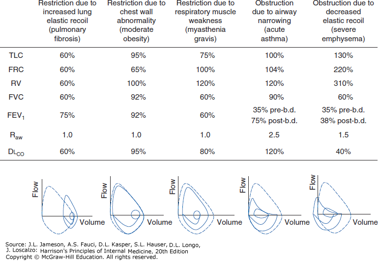 Common abnormalities of pulmonary function showing pulmonary fibrosis, obesity, myasthenia gravis, acute asthma, and severe emphysema with values and flow-volume loops